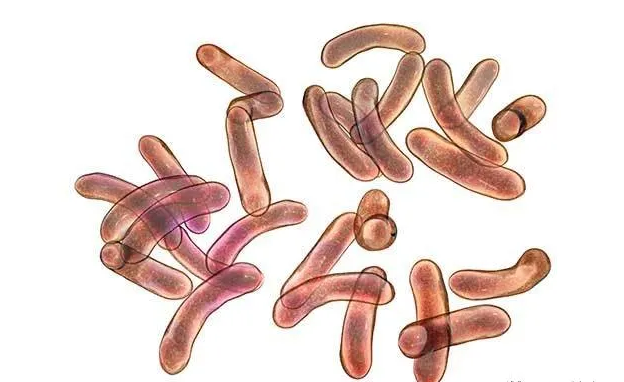 弧菌细菌污染